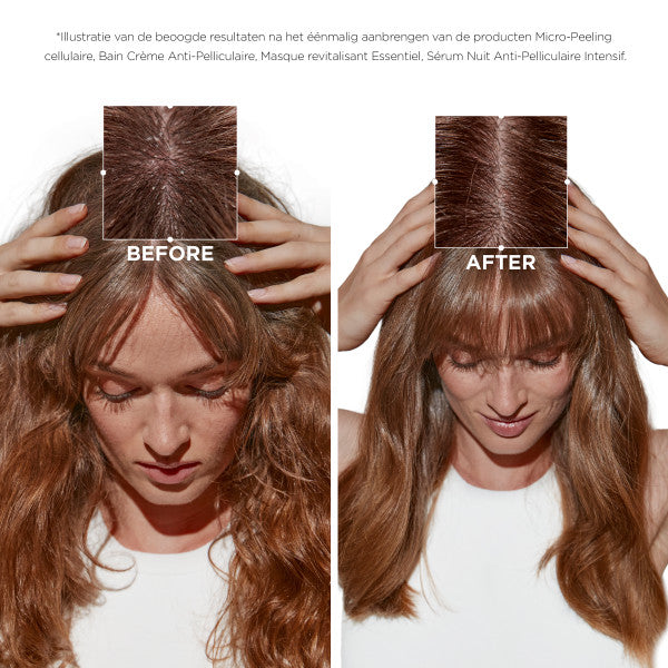 Kerastase Symbiose Micropeel before and after