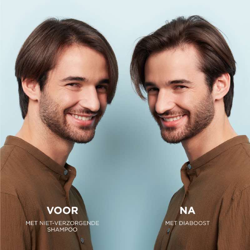Nioxin Professional System 2 scalp revitalizer Voor en Na Lang haar man