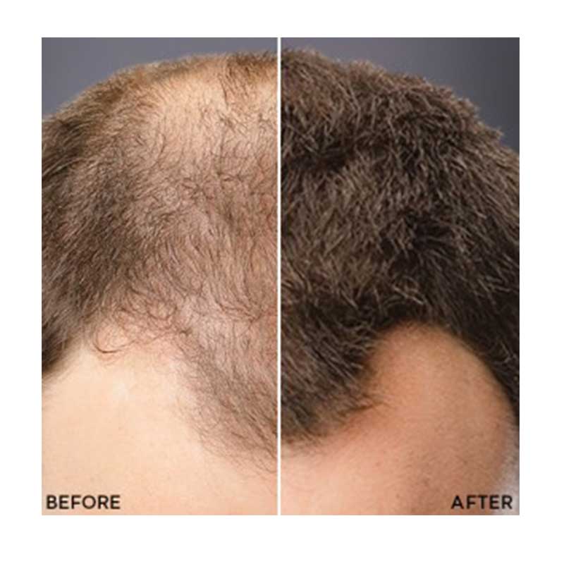 Toppik Colored Hair Spray Before and After 