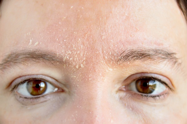 Verscheidenheid voorspelling ketting Last van een gevoelige of droge huid? Lees wat squalaan voor je kan  betekenen.